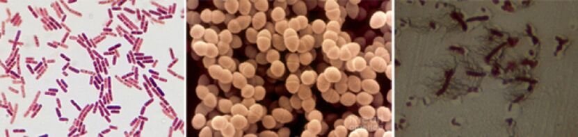 Escherichia tayoqlari, fajal enterococcus va proj - surunkali bakterial prostatitning asosiy patogenlari