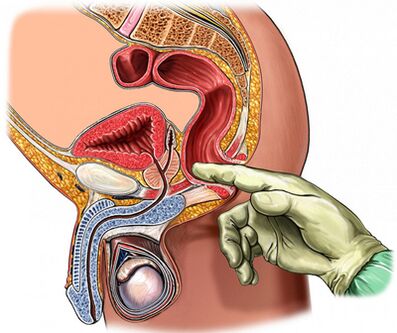 Raqamli prostate tekshirish